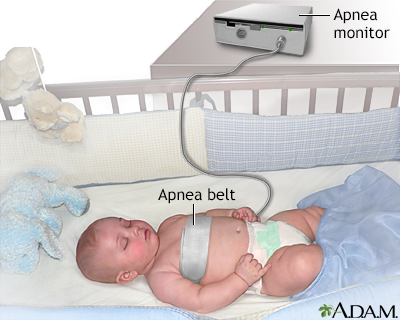 breathing monitor for infants