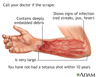 Scrape - Illustration Thumbnail
              