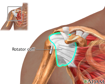 rotator cuff repair recovery