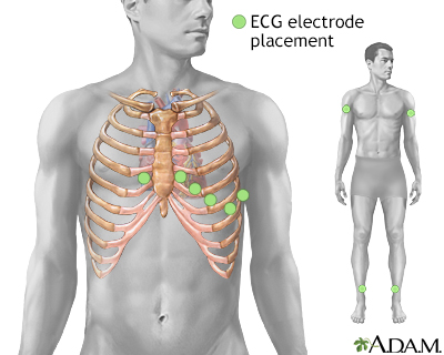 ECG electrode placement - Illustration Thumbnail
                      