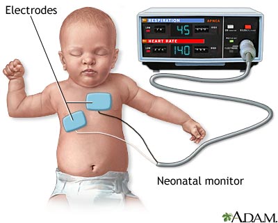 Heart - respiratory monitor  - Illustration Thumbnail
              
