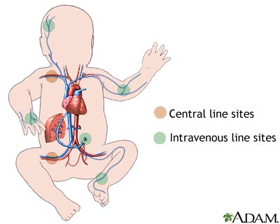 Intravenous fluid sites - Illustration Thumbnail
              