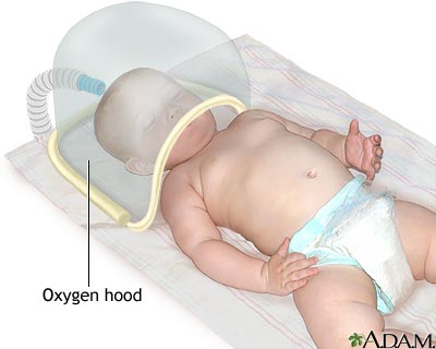 Oxygen hood - Illustration Thumbnail
                      