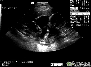 Ultrasound, normal fetus - arm and legs - Illustration Thumbnail                    