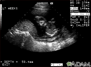 Ultrasound, normal fetus - face - Illustration Thumbnail
              