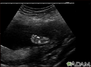 Ultrasound, normal fetus - foot - Illustration Thumbnail
                      