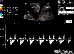 Ultrasound, normal fetus - heartbeat - Illustration Thumbnail
              