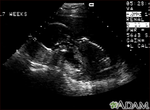 Ultrasound, normal fetus - profile view - Illustration Thumbnail
              