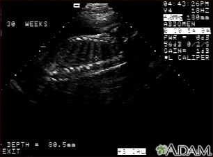 Ultrasound, normal fetus - spine and ribs - Illustration Thumbnail              