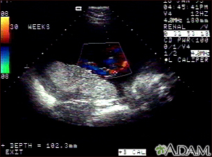 Ultrasound, color - normal umbilical cord