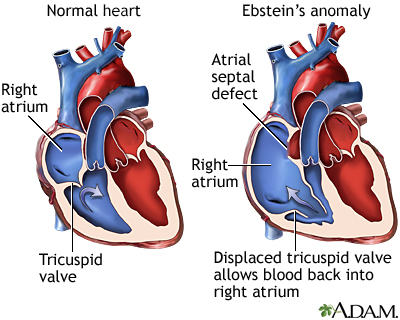 bundle of kent anatomy