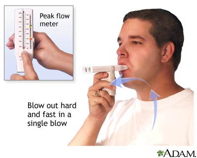 How to measure peak flow - Illustration Thumbnail
                      