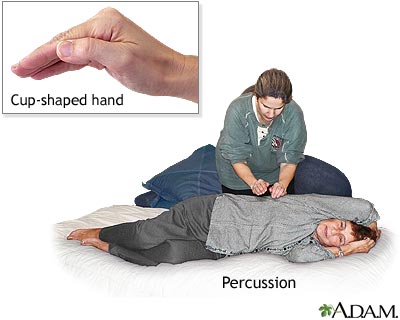 Chest Percussion Therapy