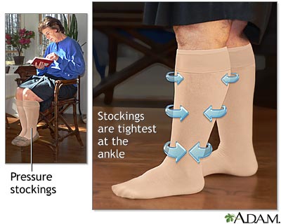 Pressure socks outlet for varicose veins