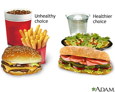 Choose the Best Answer: Eat Less Fast Food