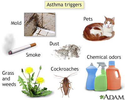 Asthma triggers - Illustration Thumbnail              