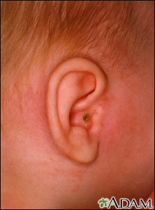 Small amounts of blood in ear canal?