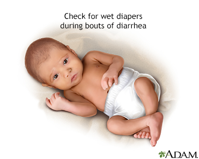 Diapers and diarrhea - Illustration Thumbnail
                      