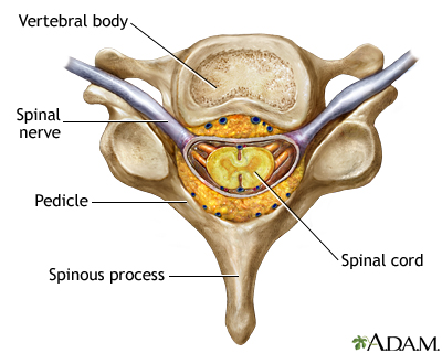 Spinal Cord Compression  Accident Care Chiropractic