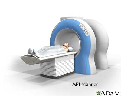 Chest MRI Information  Mount Sinai - New York