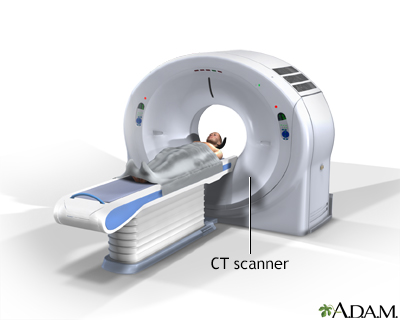 CT scan - Illustration Thumbnail