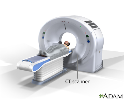 CT Cervical Spine Scan: Cost, Purpose & Result [2024]