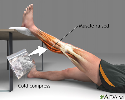 Various Muscles Strains and Their Treatment