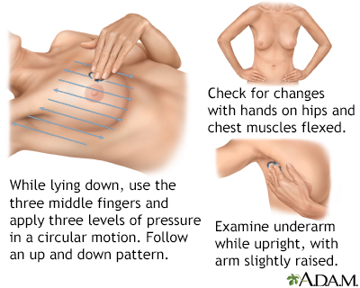 Breast self-exam - Illustration Thumbnail
                      