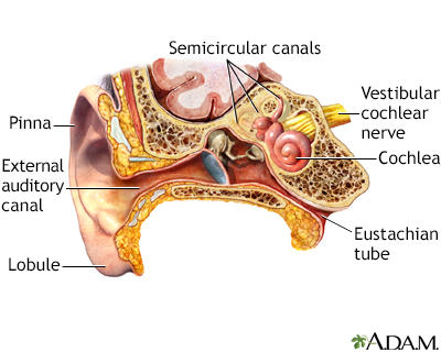 Inner ear hot sale infection tinnitus