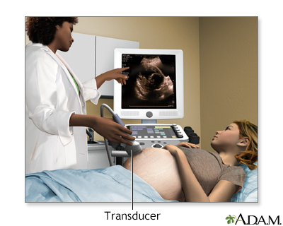 Ultrasound