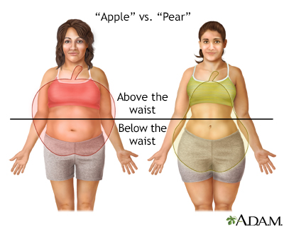 Health risks for a pear-shaped person