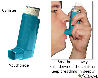 Inhaler medication administration - Illustration Thumbnail
              