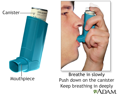 How to use an inhaler no spacer Information Mount Sinai New York