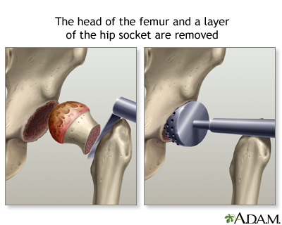 Procedure, part 1