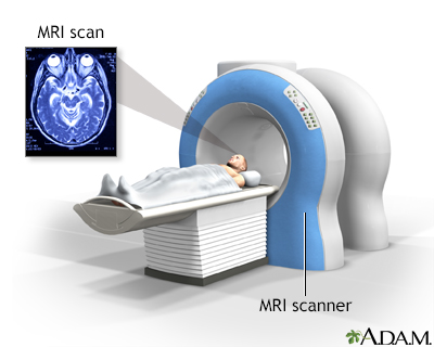Head MRI - Illustration Thumbnail              