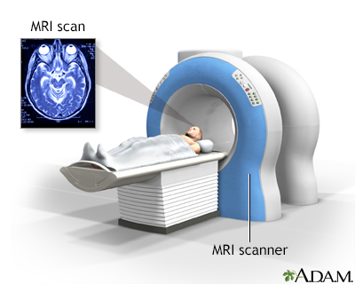 Head MRI - Illustration Thumbnail
                      