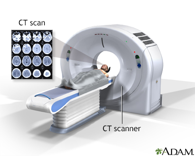 brain cat scan