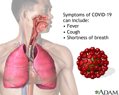 How to stop the spread of COVID-19 Information