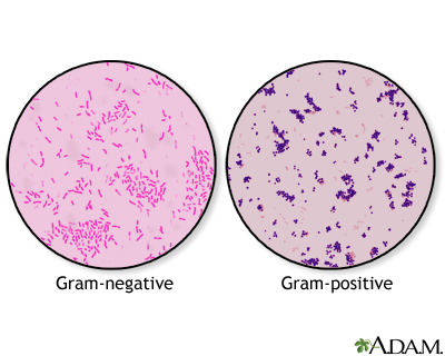 Gram stain - Illustration Thumbnail
                      