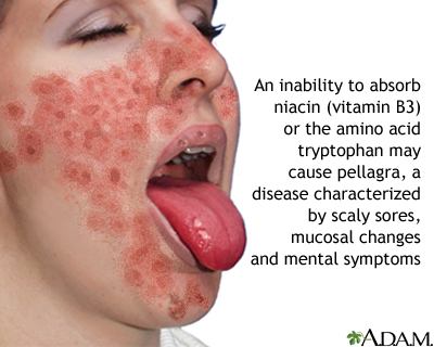 can niacin cause a rash