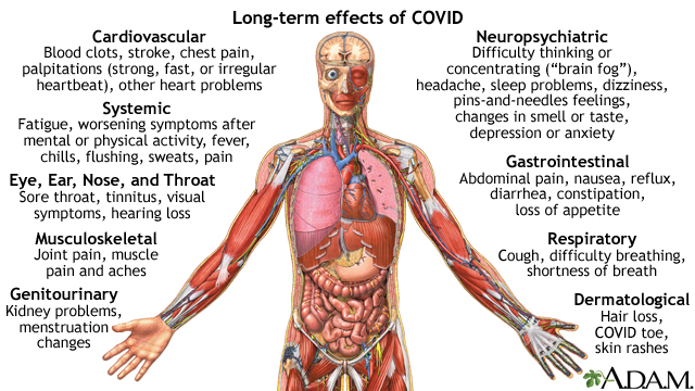 Long-term effects of COVID - Illustration Thumbnail
              
