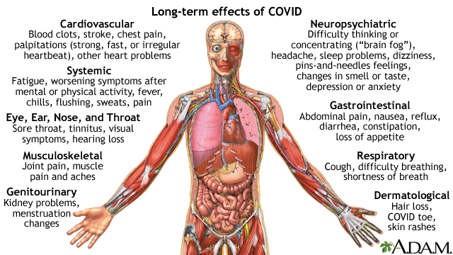 Long Covid causes changes in body that make exercise debilitating