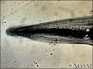 Pinworm - close-up of the head - Illustration Thumbnail
              