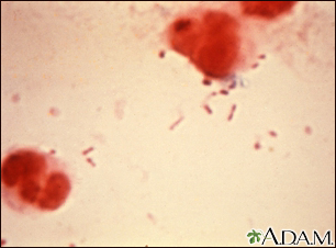 Haemophilus influenzae organism - Illustration Thumbnail
                      