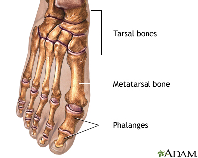 Foot pain Information  Mount Sinai - New York