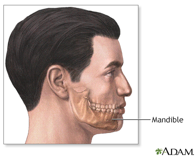 Chin augmentation - series - Presentation Thumbnail
              