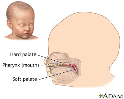 Cleft lip repair - series - Presentation Thumbnail
                    