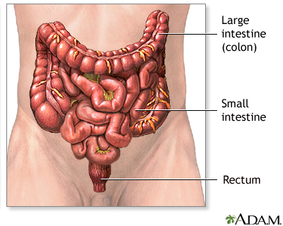 Coping with a colostomy after anal cancer  Cancer Research UK