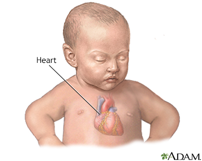 Patent ductus arteriosis (PDA) - series - Infant heart anatomy - Presentation Thumbnail
              
