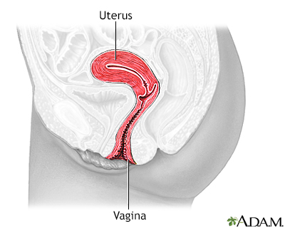 Dilatation and curettage